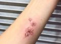 Cherry Blossom Tattoo Design on Arm